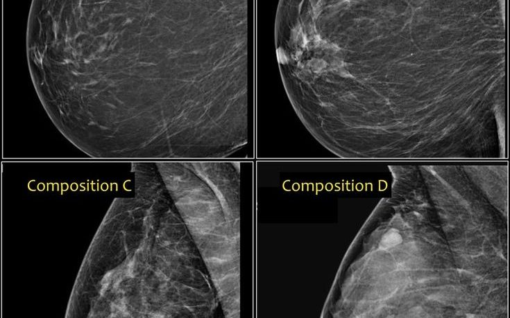 Ехомамографски изследвания Рентгенов кабинет Поли Кукушева